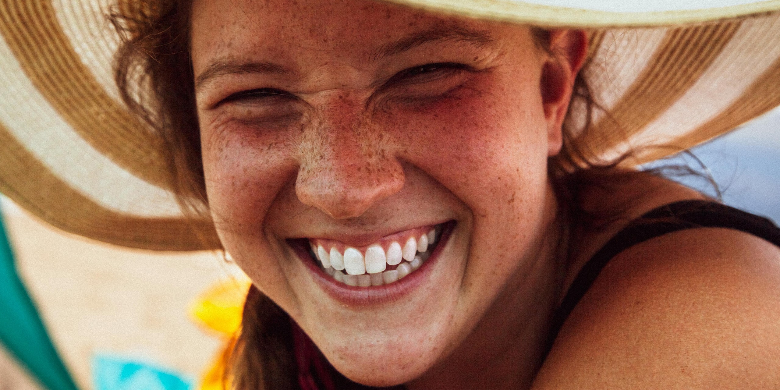 Achieve a Radiant Smile with Professional Teeth Whitening